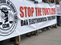 The dressed-up torture procedure called ECT