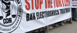 The dressed-up torture procedure called ECT