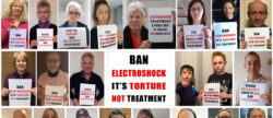 Psychiatrists in denial about causing brain damage with ECT
