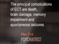 ECT causes significant and irreversible brain damage